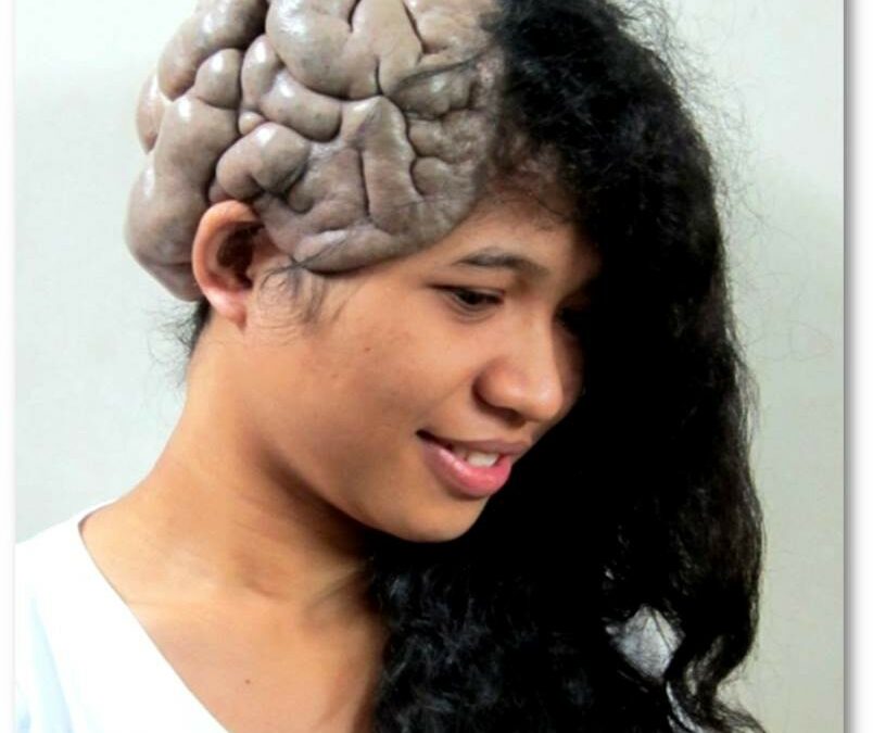 Flashback of Hope’s Beginning; Cylindroma Survivor