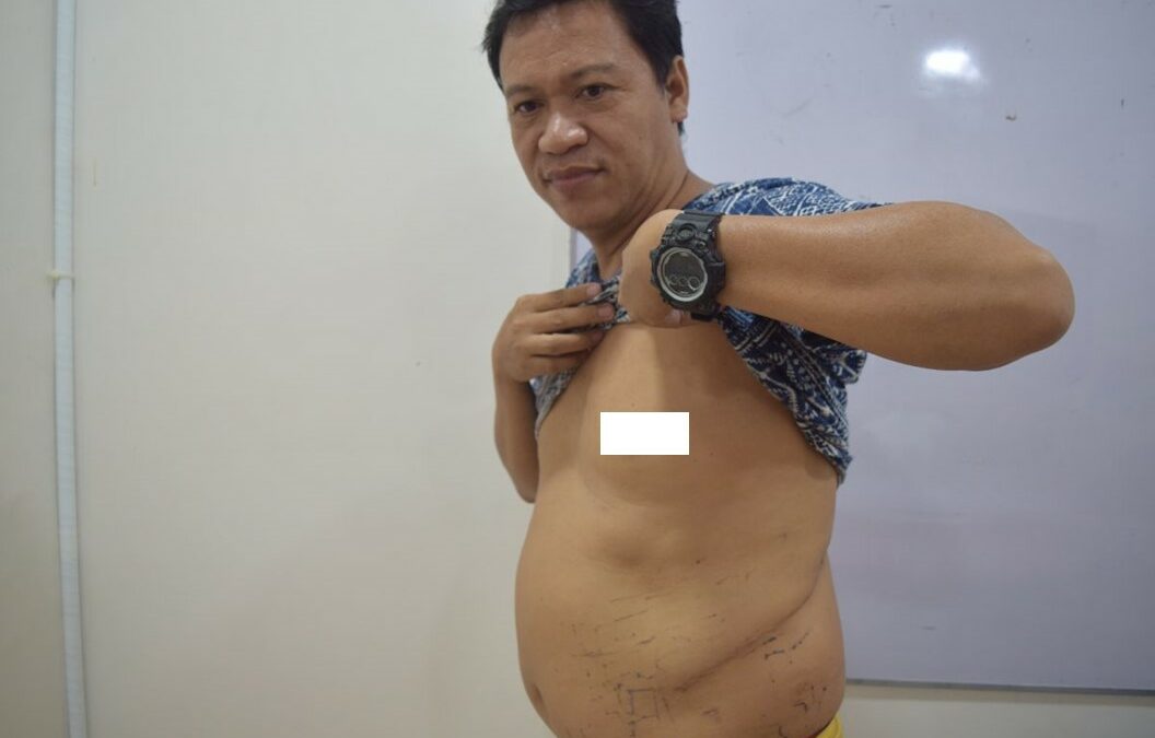 Renal Surgery Brings Hope to a Loving Father