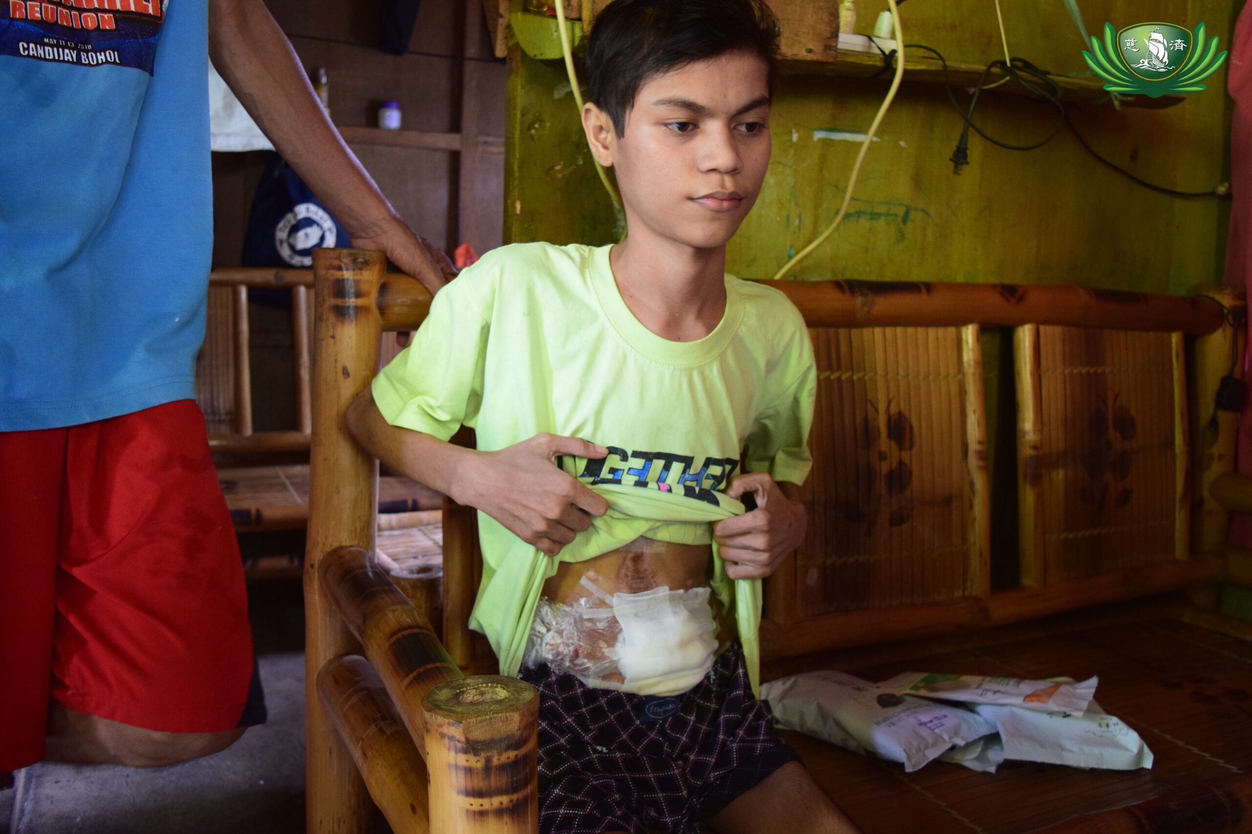 Renopal's condition 4 years ago during home visit.